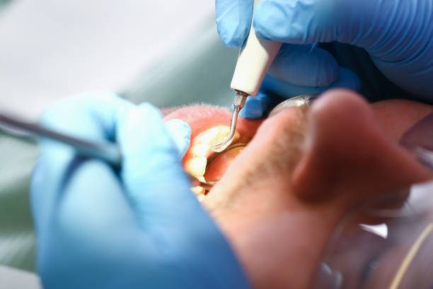 Best Emergency Orthodontic Repairs in Unadilla, GA